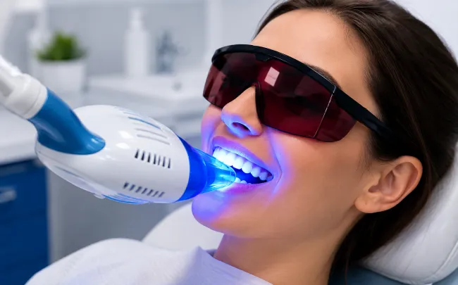 Teeth Whitening