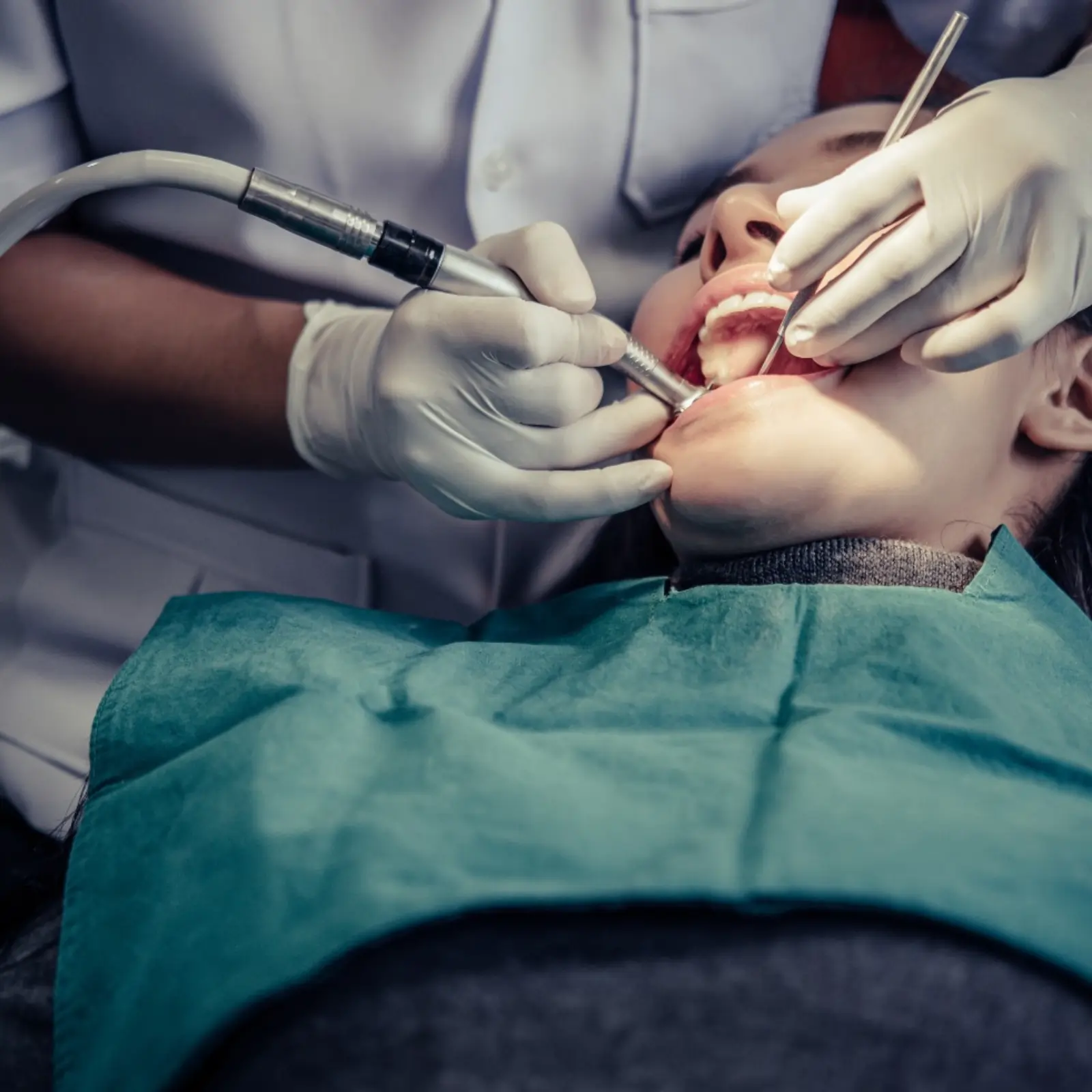 Dentist performing root canal treatment in Muscat using dental instruments during a professional tooth infection procedure.